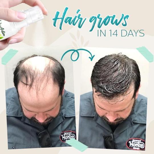 Spray de jengibre potenciador de raíces activo para el cabello - Imagen 2