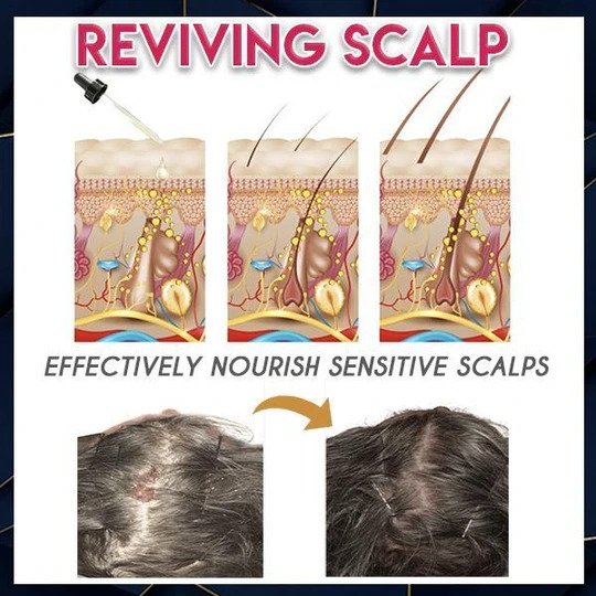 Esencia pura para el crecimiento del cabello - Imagen 2