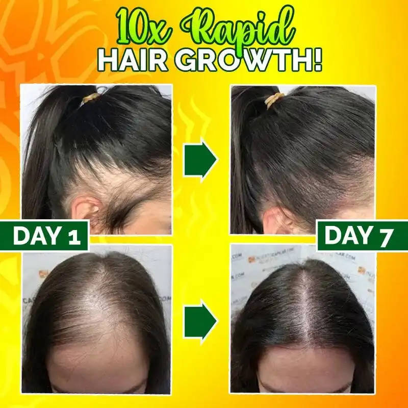 Suero para cabello fuerte 10X-Regro - Imagen 3