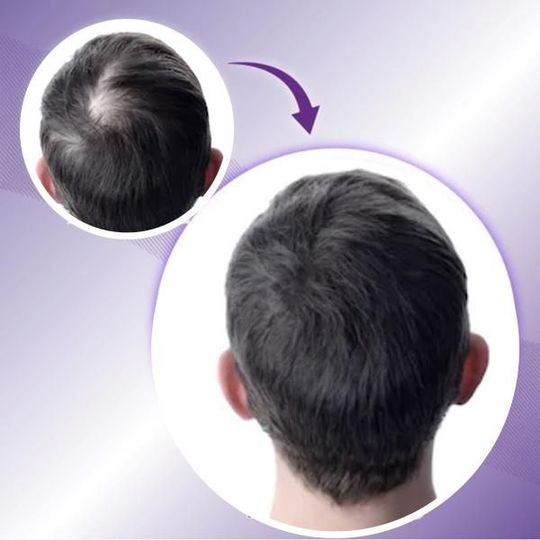 Adorno para el cabello con clip sedoso - Imagen 4