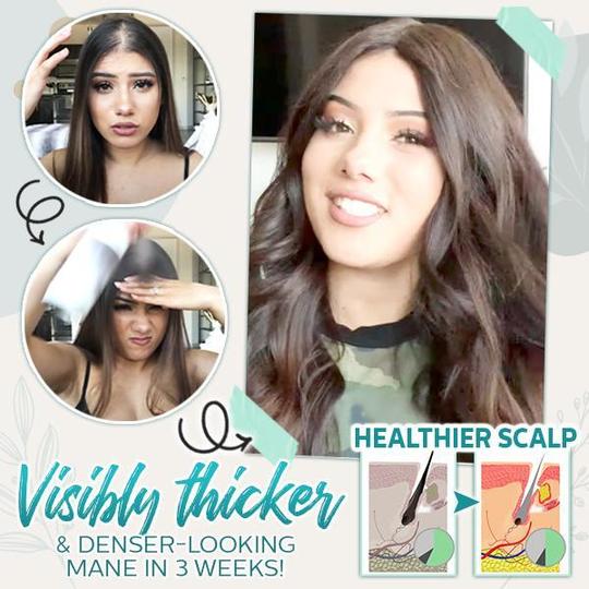 Spray de jengibre potenciador de raíces activo para el cabello - Imagen 4