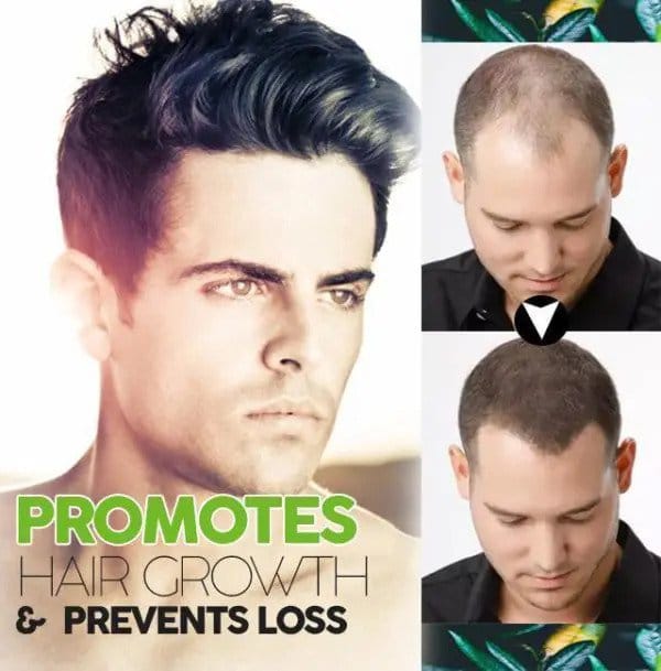 Solución orgánica para oscurecer el cabello - Imagen 3