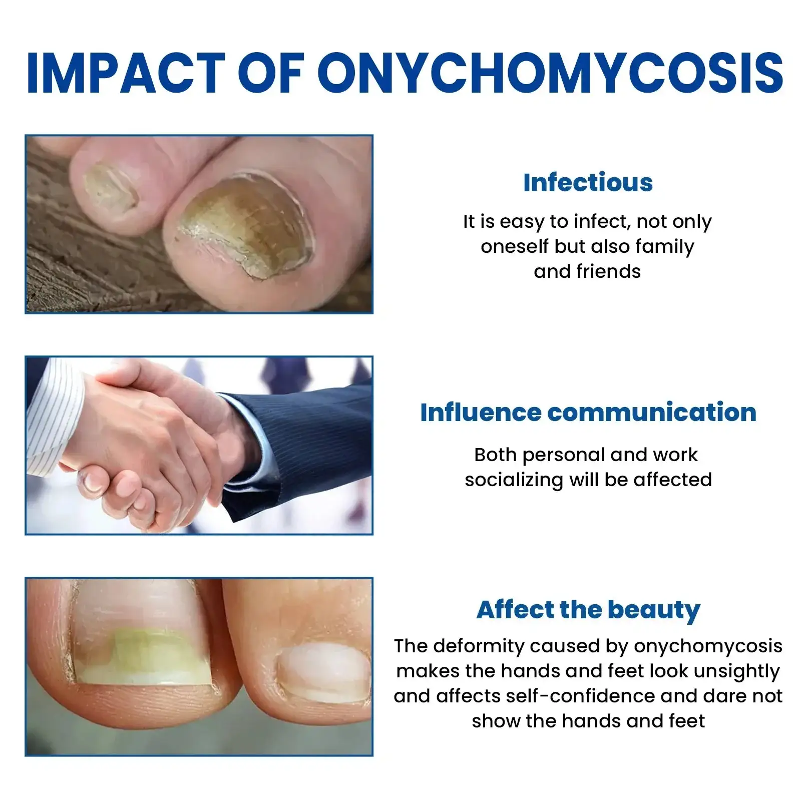 Parches reparadores de uñas con hongos - Imagen 2