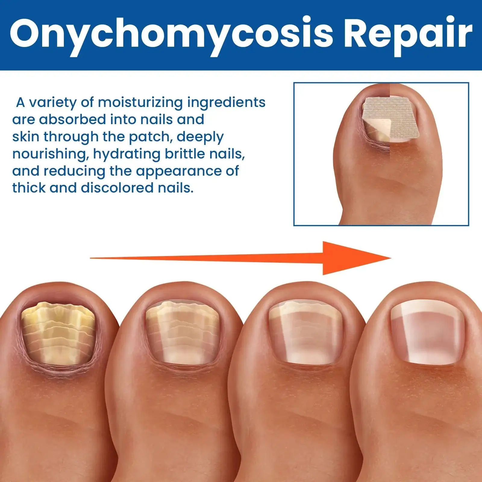 Parches reparadores de uñas con hongos - Imagen 4