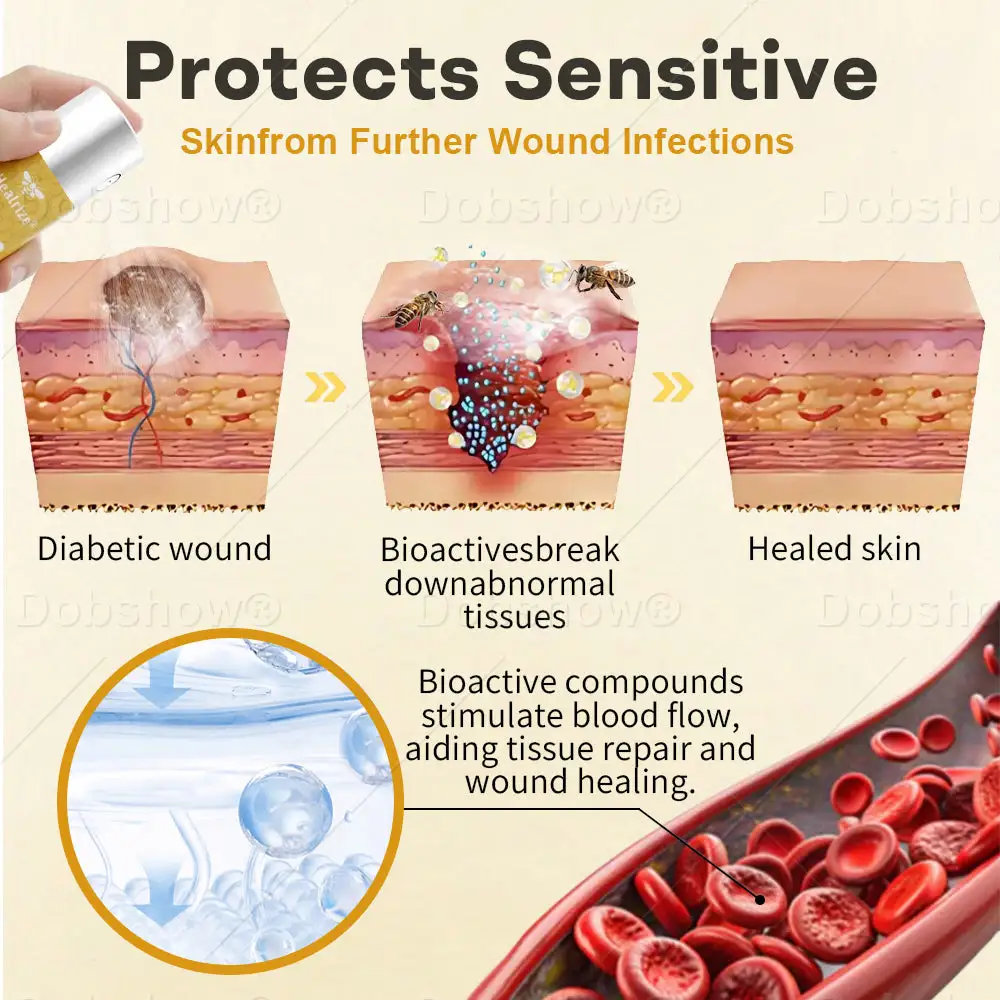 Spray para heridas con veneno de abeja GlucoShield - Imagen 3