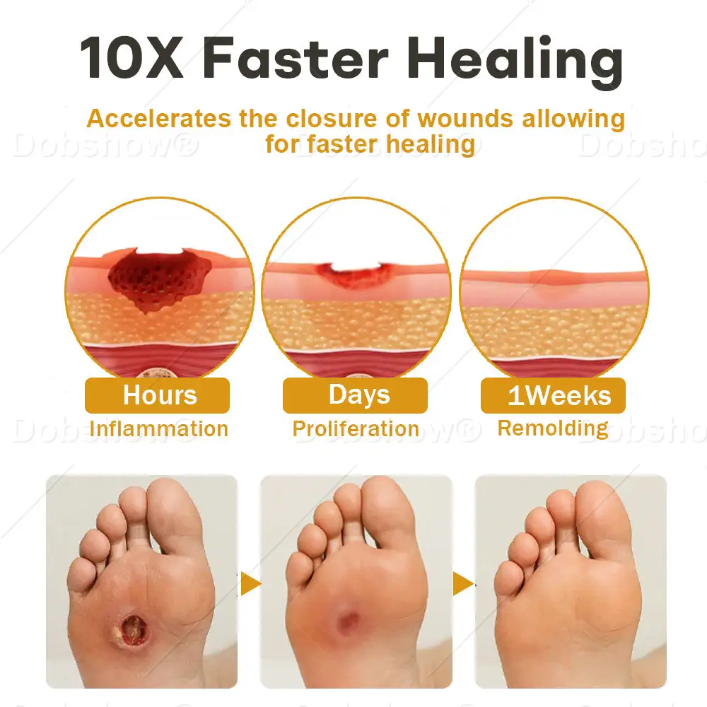 Spray para heridas con veneno de abeja GlucoShield - Imagen 4