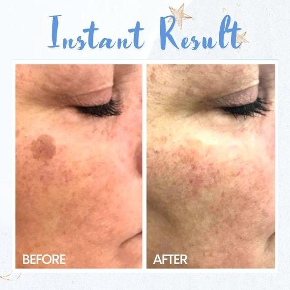 Pluma de eliminación de manchas - Imagen 3