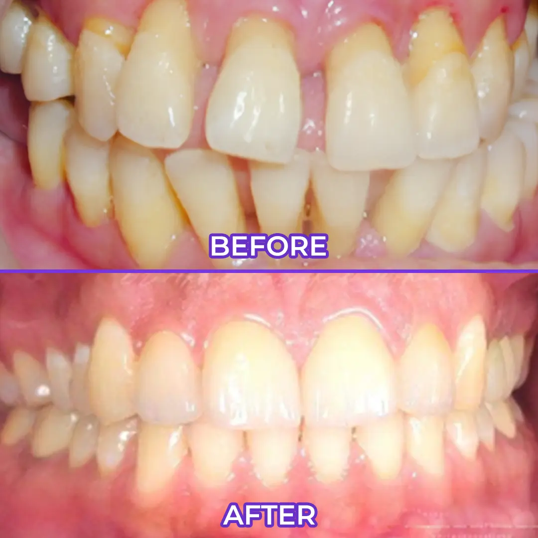 Pasta dental con fluoruro SensiGum - Imagen 2