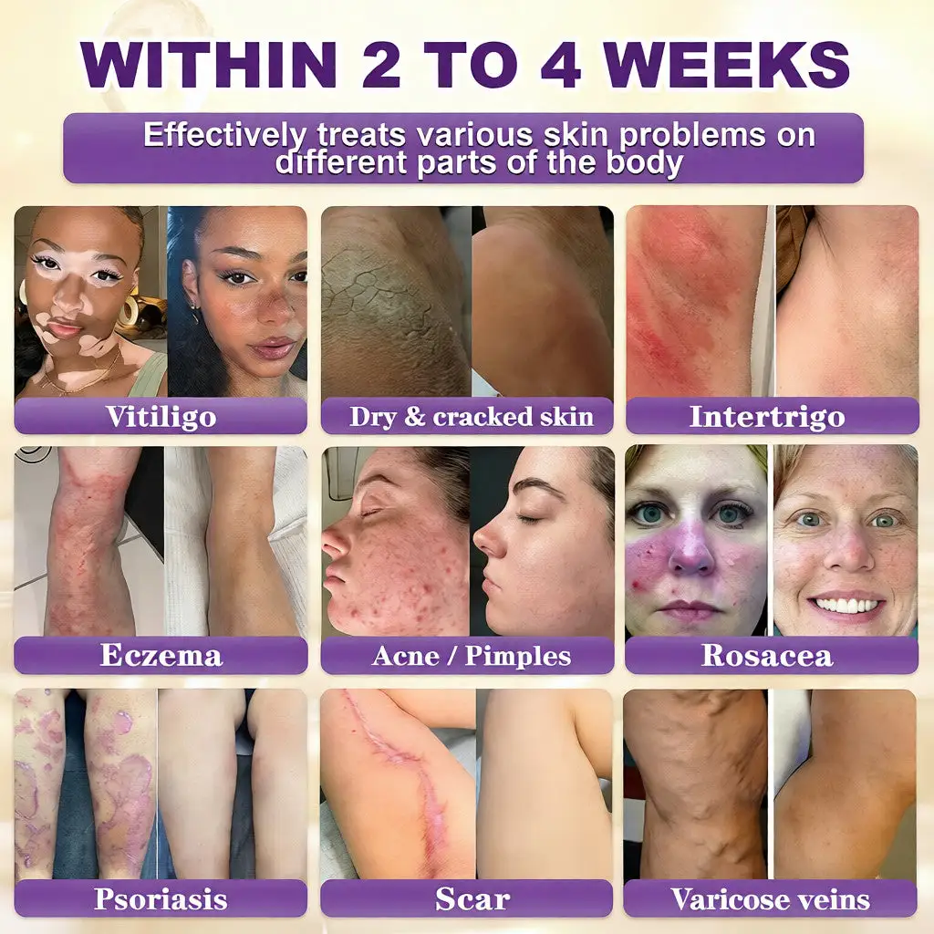 Crema restauradora de la piel 10 en 1 con biotina - Imagen 2