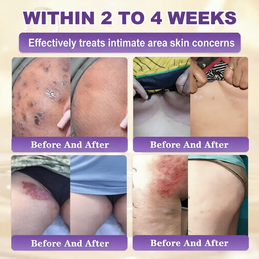 Crema restauradora de la piel 10 en 1 con biotina - Imagen 4