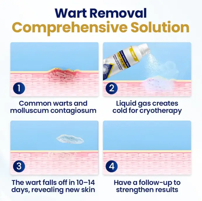 Spray renovador de golpes Chillique - Imagen 3